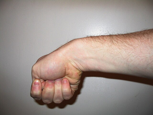 손목 통증 자가진단 핀켈스타인 테스트 드퀘르벵 확인