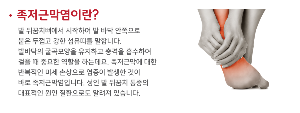 족저근막염 원인과 발뒤꿈치 통증 부위 설명 이미지