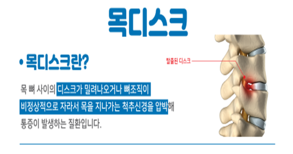 목 디스크 설명